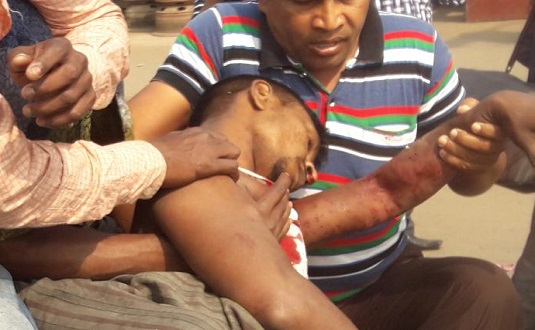 রাজধানীর গাবতলীতে শ্রমিক-পুলিশ সংঘর্ষে নিহত ১