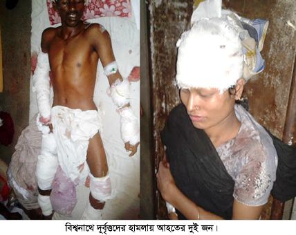 বিশ্বনাথে দূর্বৃত্তদের হামলায় শিশুসহ স্বামী-স্ত্রী আহত