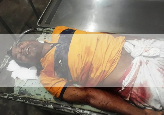 সিলেটে ‘বন্দুকযুদ্ধে’ মাদক ব্যবসায়ী নিহত
