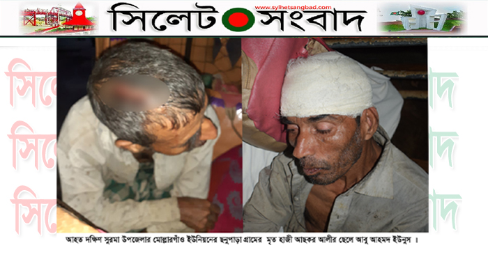 দক্ষিণ সুরমায় ছোট ভাইয়ের হাতে বড় ভাই-ভাবি আহত