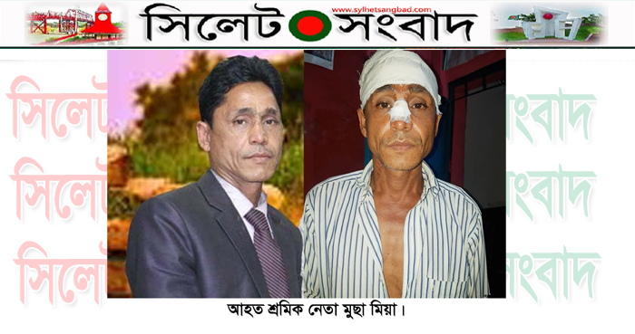 সিলেটে শ্রমিক নেতা মুছার উপর হামলা