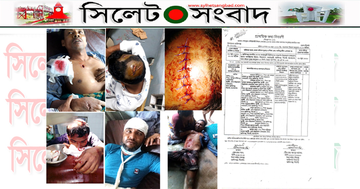 ফতোয়াকে কেন্দ্র করে জকিগঞ্জে সংঘর্ষে ১১ জন আহত : মামলা দায়ের
