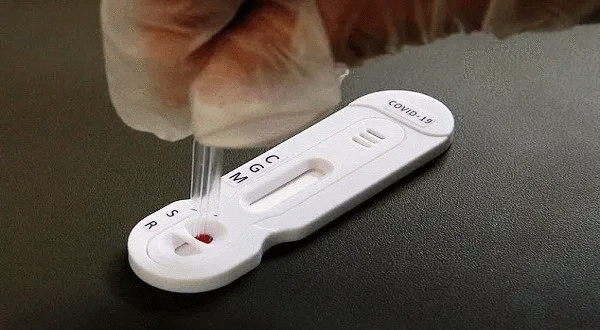 করোনাভাইরাসের এন্টিবডি পরীক্ষায় মাত্র ২০ মিনিটে মিলবে ফলাফল