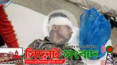 শাবিতে ছবি তুলতে যাবার পথে আখালিয়ায় সড়কে প্রাণ গেল যুবকের