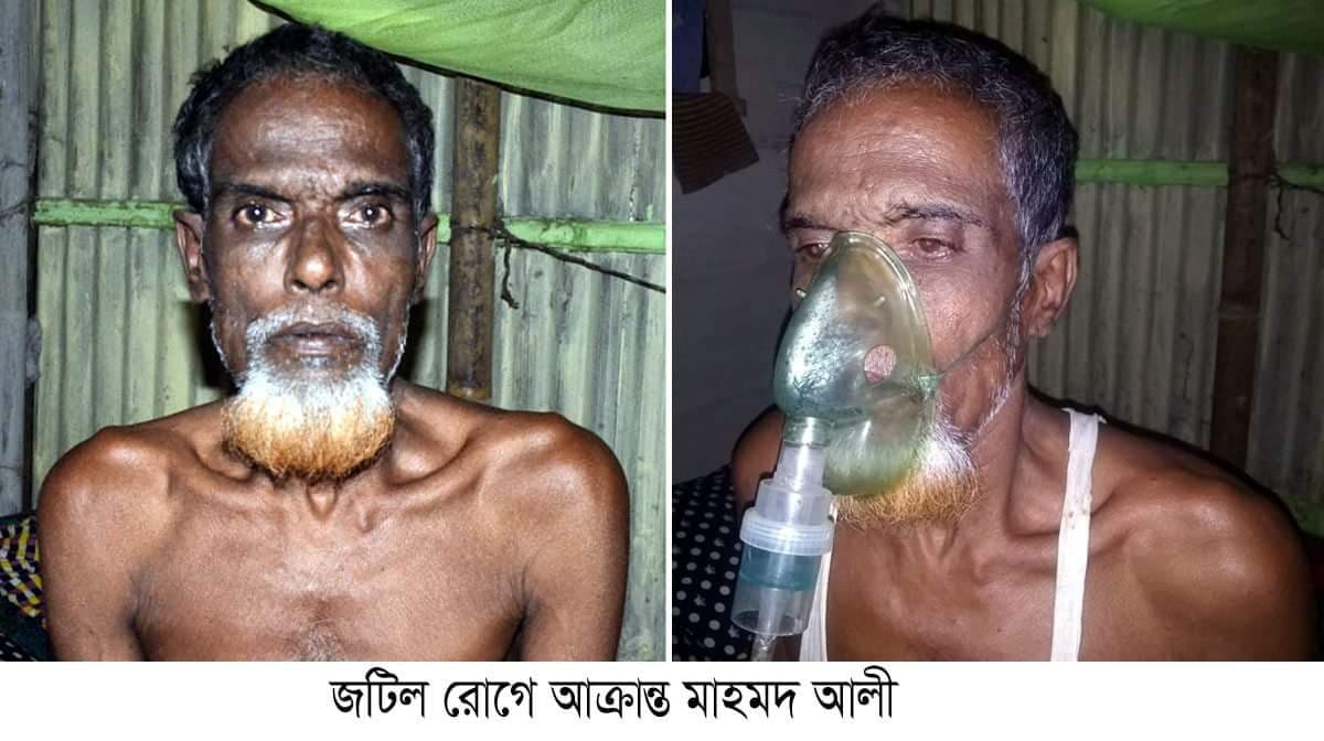 জটিল রোগে আক্রান্ত মাহমদ আলী সকলের সহযোগিতায় বাঁচতে চায়