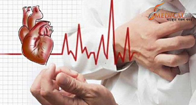 স্ট্রোকের ঝুঁকি এড়াতে যা করবেন