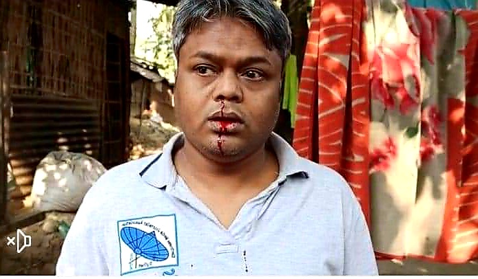 পঞ্চম বারের মতো আবারও হামলার শিকার সাংবাদিক সাকি, আটক ২