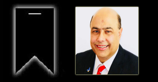 জকিগঞ্জের কৃতিসন্তান এনামুল হক চৌধুরী আর নেই