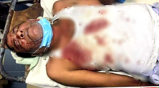 আকমল আলীর উপর সন্ত্রাসী হামলার নিন্দা ও প্রতিবাদ  জানিয়েছে খোজারখলা আদর্শ সংঘ