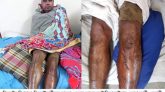 বিশ্বনাথে ৫০ হাজার টাকা ছিনতাইকালে যুবক গুরুতর আহত