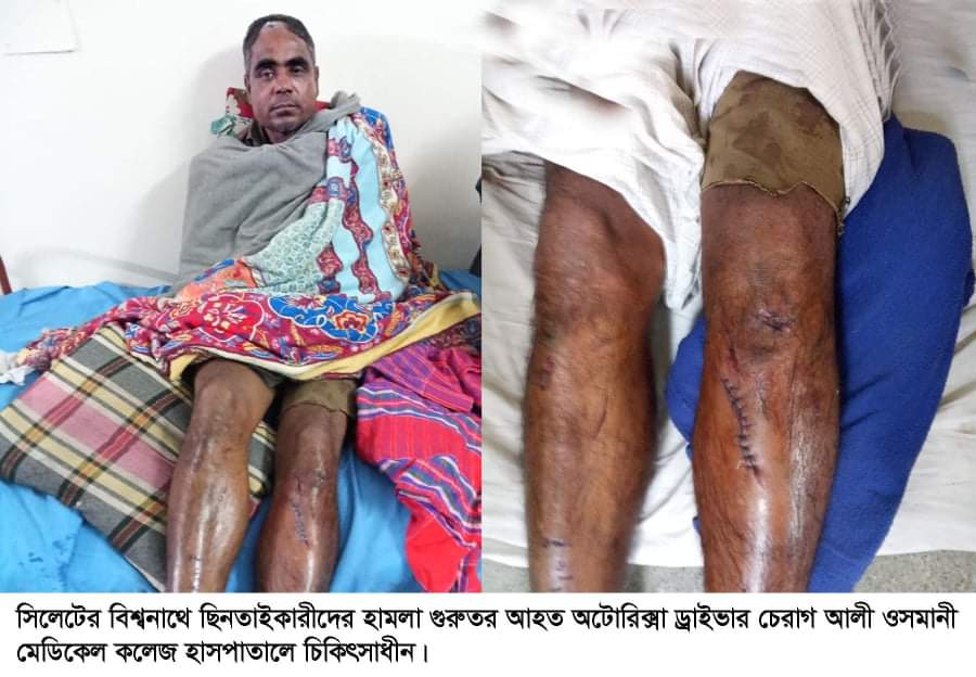 বিশ্বনাথে ৫০ হাজার টাকা ছিনতাইকালে যুবক গুরুতর আহত