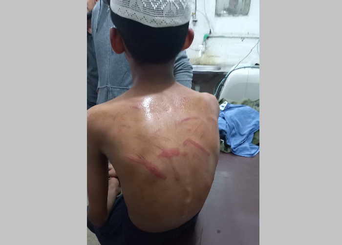 গোলাপগঞ্জে মাদ্রাসা শিক্ষকের মারধরে হাসপাতালে ছাত্র