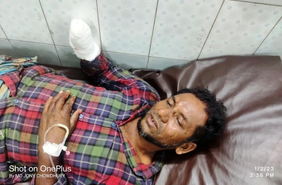কোম্পানীগঞ্জে যুবকের হাতের কব্জি বিচ্ছিন্ন করল চাচাতো ভাইয়েরা
