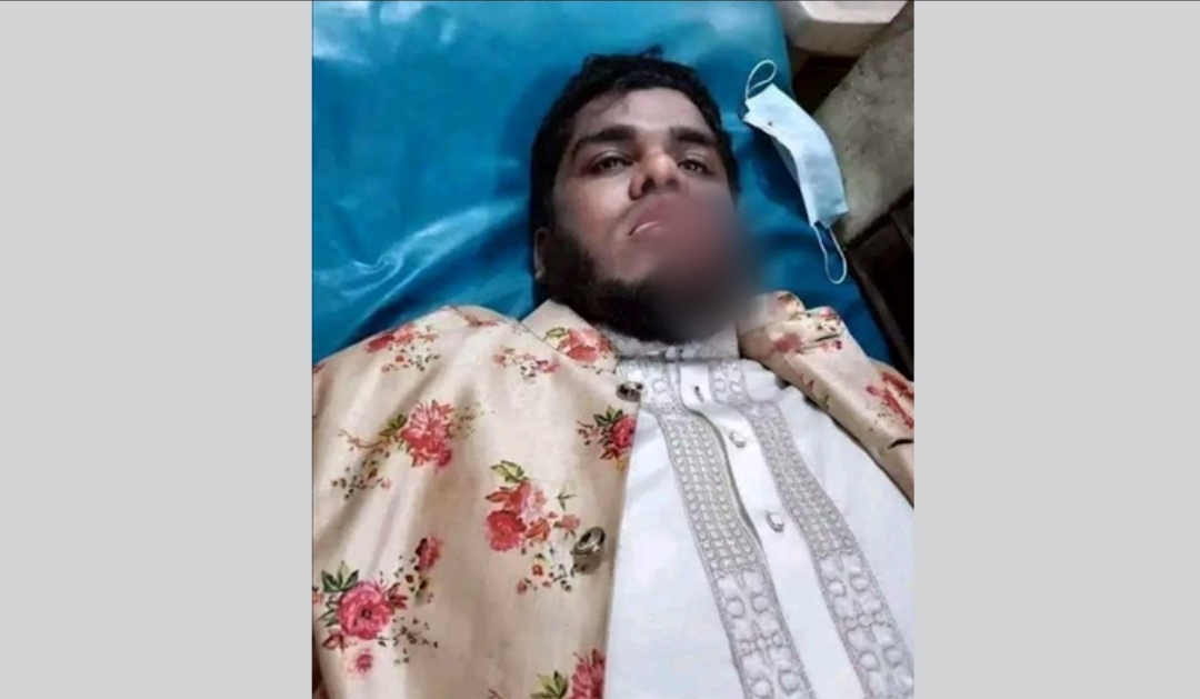 ব্রাহ্মণবাড়িয়ায় ইসলামি বক্তার ওপর হামলা, জিভ কর্তন