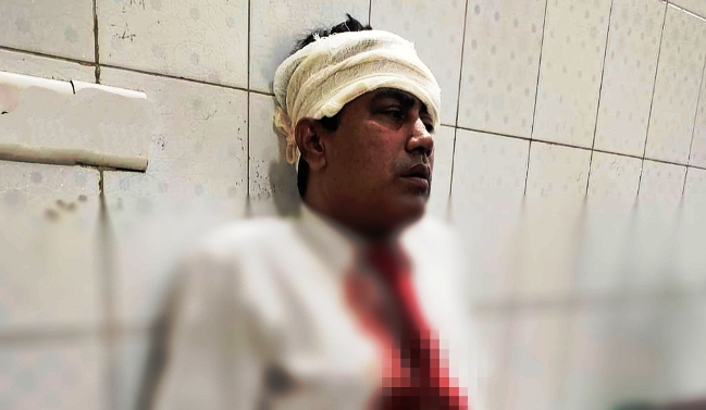 সিলেটে জয়ন্তিকা ট্রেনে পাথর নিক্ষেপে পরিচালক আহত