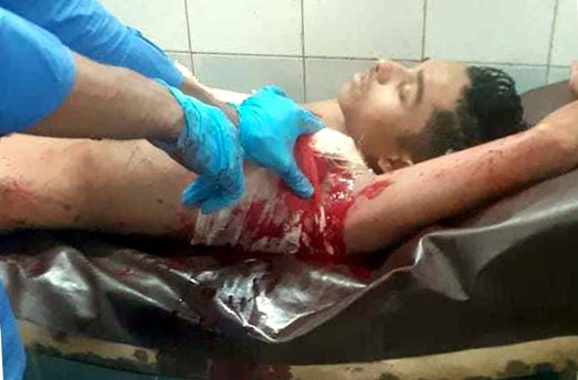 দক্ষিণ সুরমায় হামলায় স্কুল ছাত্র আহত, আটক ১