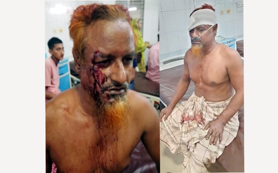 মাওলানা জেহাদী ও তার স্ত্রীর উপর সন্ত্রাসী হামলা