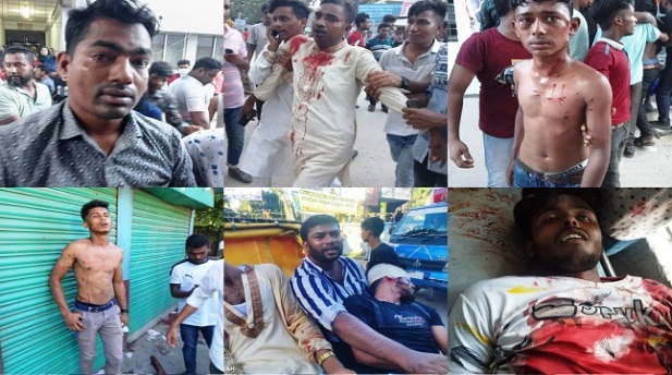 লক্ষ্মীপুরে পুলিশ-বিএনপি সংঘর্ষে নিহত ১, আহত শতাধিক