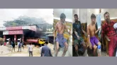 সিলেটে সিএনজি পাম্পে আগুন, দগ্ধ ২ জনকে ঢাকার প্রেরণ