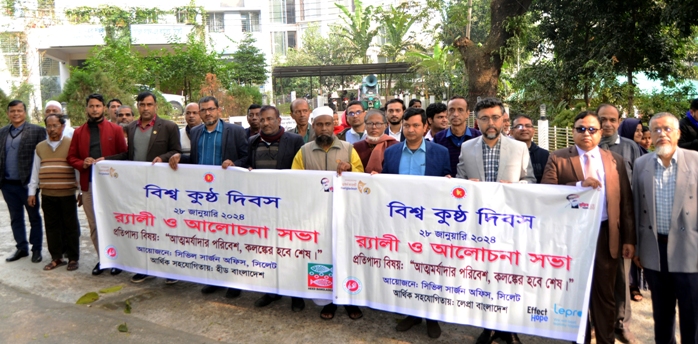সিলেটে কুষ্ঠ আক্রান্ত হয়ে চিকিৎসাধীন ৫৩০ জন