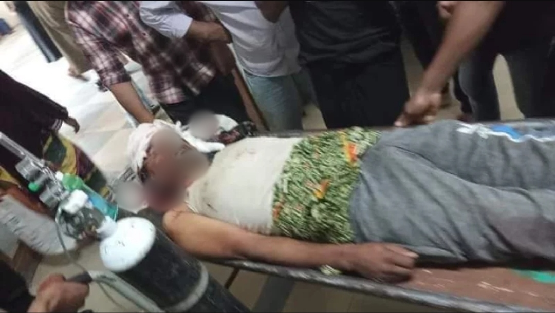 রাজনগরে ভাইয়ের কুড়ালের আঘাতে ভাই খুন