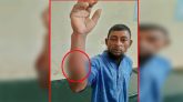 কুলাউড়ায় কুকুরের কামড়ে ২১ নারী-পুরুষ আহত