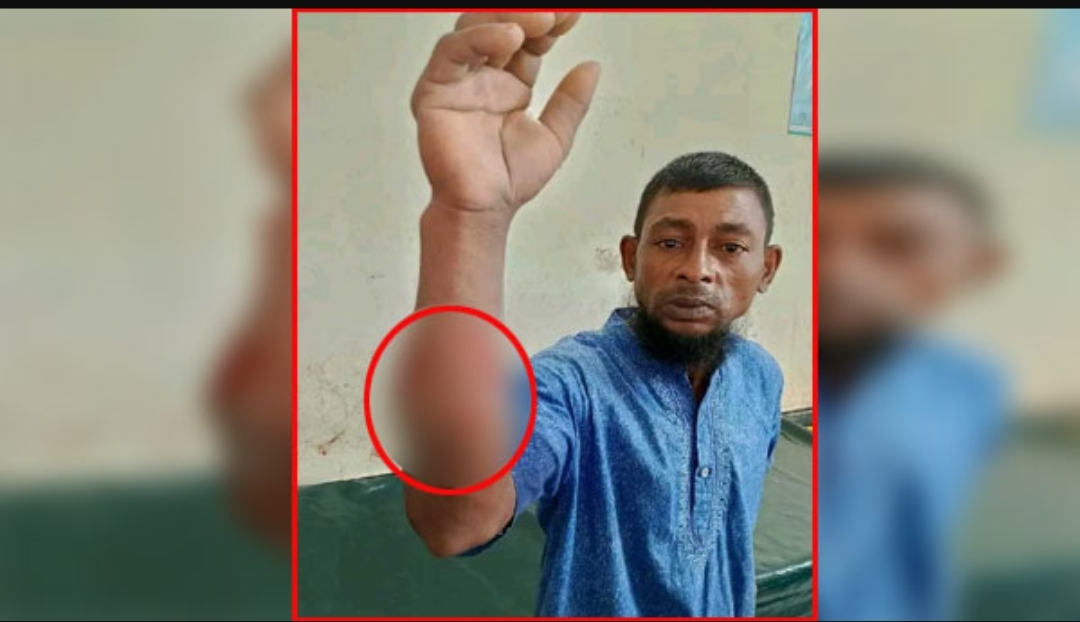 কুলাউড়ায় কুকুরের কামড়ে ২১ নারী-পুরুষ আহত