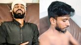 সিলেট নগরীতে হামলায় ২ ছাত্রদল কর্মী আহত
