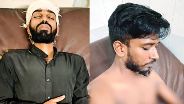 সিলেট নগরীতে হামলায় ২ ছাত্রদল কর্মী আহত