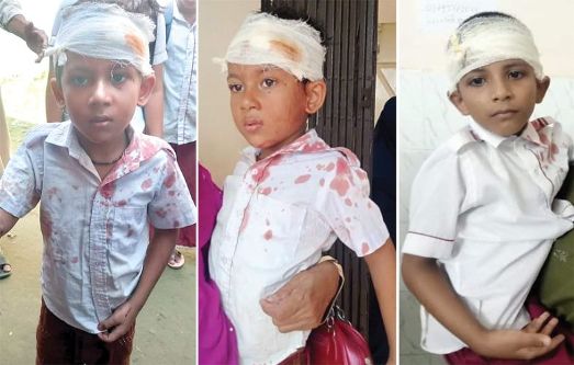 বালাগঞ্জে ক্লাস চলাকালে ফ্যান পড়ে ৩ শিক্ষার্থী আহত