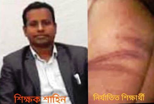 ছাতকে শিক্ষকের বিরুদ্ধে দুই শিক্ষার্থীকে নির্যাতনের অভিযোগ