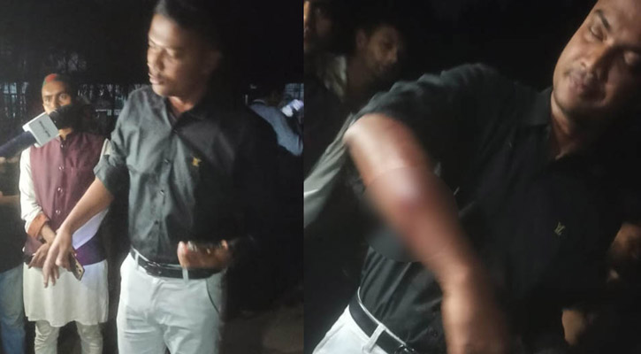 গাজীপুরে মোটরসাইকেলে এসে বৈষম্যবিরোধী ছাত্রদের লক্ষ্য করে গুলি