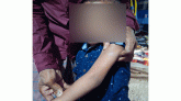 কানাইঘাটে শিশুদের ওপর বানরের আক্রমণ, আতঙ্ক