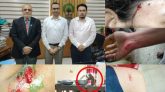 সিকৃবিতে বানরের আক্রমণে শতাধিক ছাত্রী আহত, প্রধান বন সংরক্ষকের সাথে ভিসির বৈঠক
