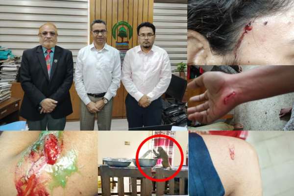 সিকৃবিতে বানরের আক্রমণে শতাধিক ছাত্রী আহত, প্রধান বন সংরক্ষকের সাথে ভিসির বৈঠক