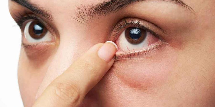 অন্ধত্ব নিরাময়ে নতুন আশার আলো