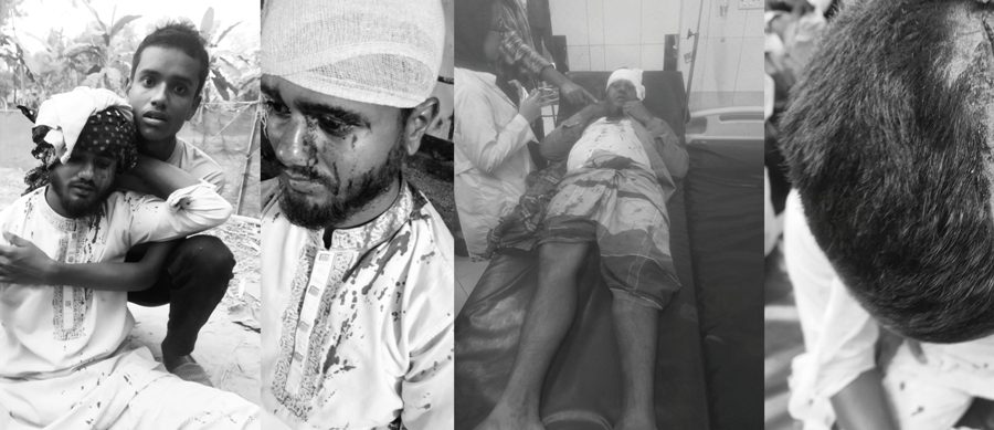 জৈন্তাপুরে দুই পক্ষের সংঘর্ষে আহত ৭