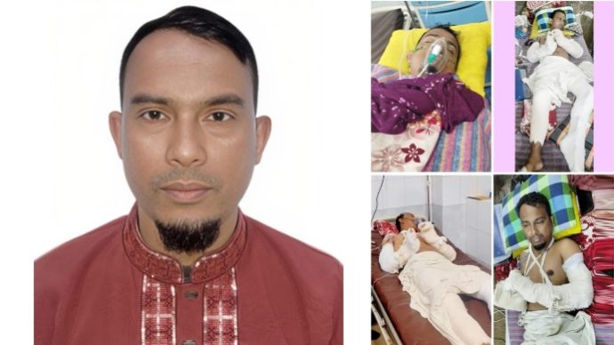 কমলগঞ্জে সন্ত্রাসী হামলায় আহত সাংবাদিক বাছিতের মানবেতর জীবন