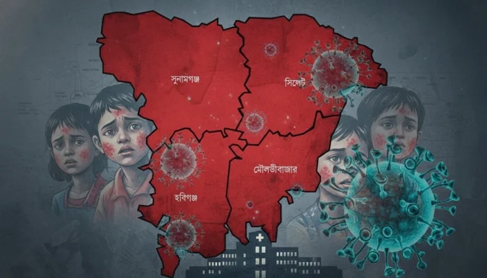 সিলেটে বাড়ছে হামের প্রকোপ, হাসপাতালে ভর্তি ১২ শিশু