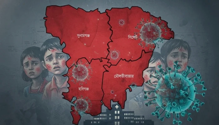 সিলেটে হাম উপসর্গে একদিনেই ৩ শিশুর মৃত্যু