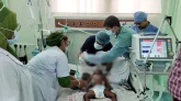 হামের উপসর্গ নিয়ে আরও ১০ শিশুর মৃত্যু