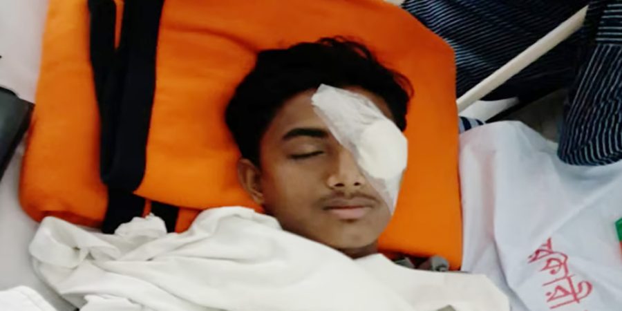 হবিগঞ্জে হামলায় আহত আলিফের বাঁ চোখে অস্ত্রোপচার