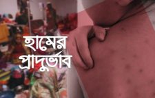 হাম ও উপসর্গে বাড়ছে মৃত্যু, ২৪ ঘণ্টায় ৭ প্রাণহানি
