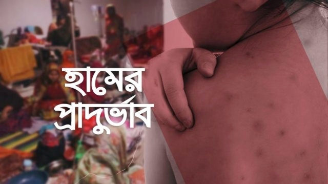 হাম ও উপসর্গে বাড়ছে মৃত্যু, ২৪ ঘণ্টায় ৭ প্রাণহানি
