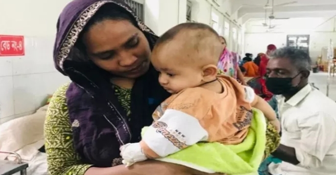 সিলেটে হামের উপসর্গে আরও ২ শিশুর মৃত্যু
