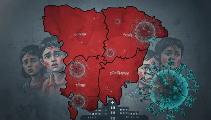 সিলেটে হামের উপসর্গে আরও ২ শিশুর মৃত্যু, প্রাণহানি বেড়ে ১৭৫