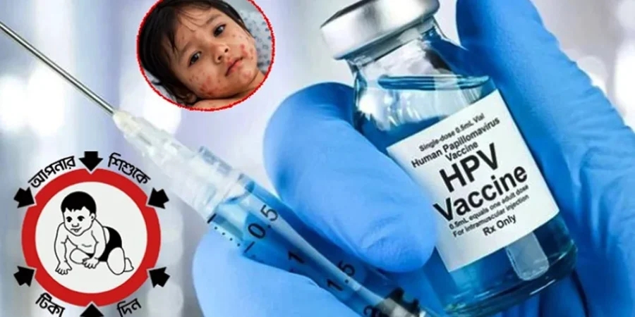 আজ থেকে হামের বিশেষ টিকা ক্যাম্পেইন শুরু