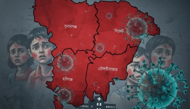 সিলেটে হামের উপসর্গে আরেক শিশুর মৃত্যু, প্রাণহানি বেড়ে ১৮১