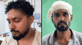 সিওমেকে দুই সাংবাদিকের রক্ত ঝরিয়েও কর্মবিরতিতে ইন্টার্ন চিকিৎসকরা